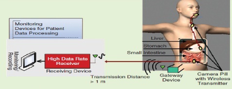 wireless endoscope monitoring system